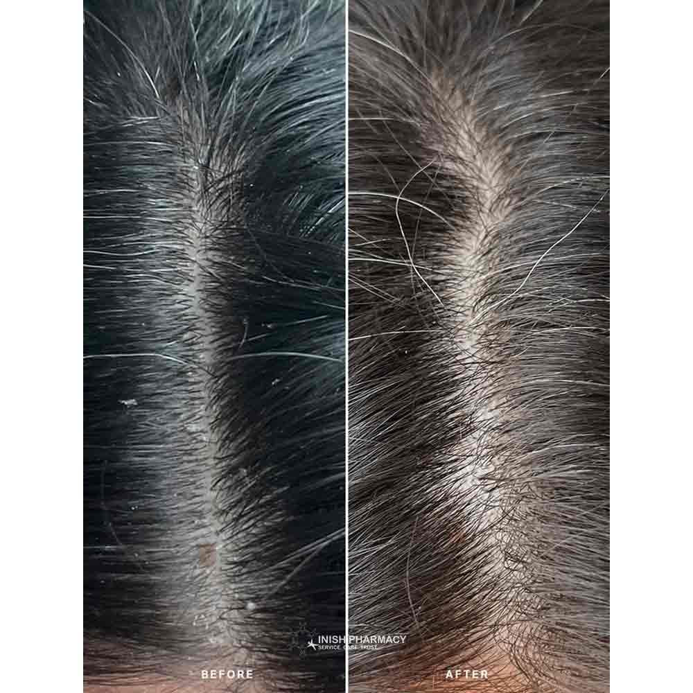 Alpha-H Healthy Scalp Treatment 100ml - Image 3