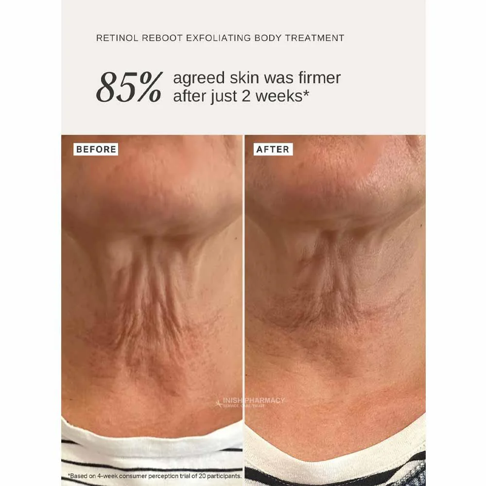 Alpha-H Retinol Reboot Body Treatment 120ml - Image 7