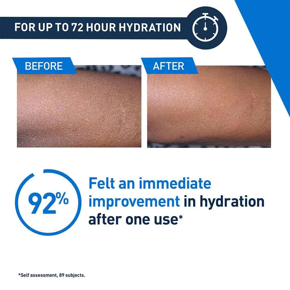 CeraVe Intensive Moisturising Lotion For Very Dry Itchy Skin - Image 7