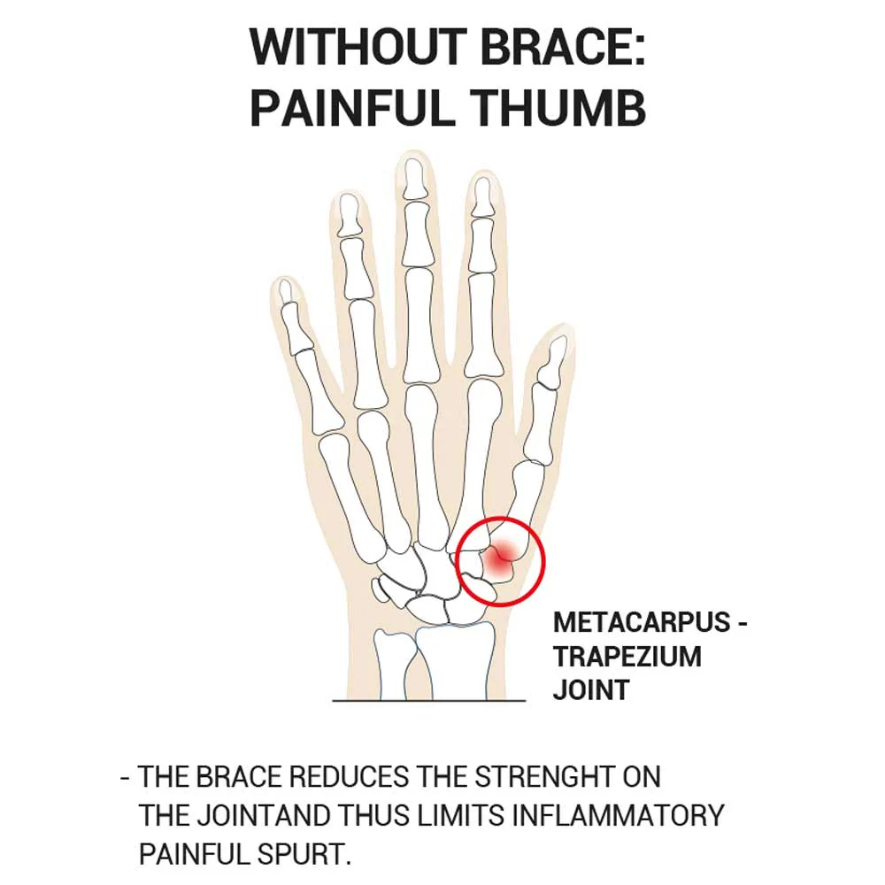 Epitact Flexible Thumb Brace - Image 3