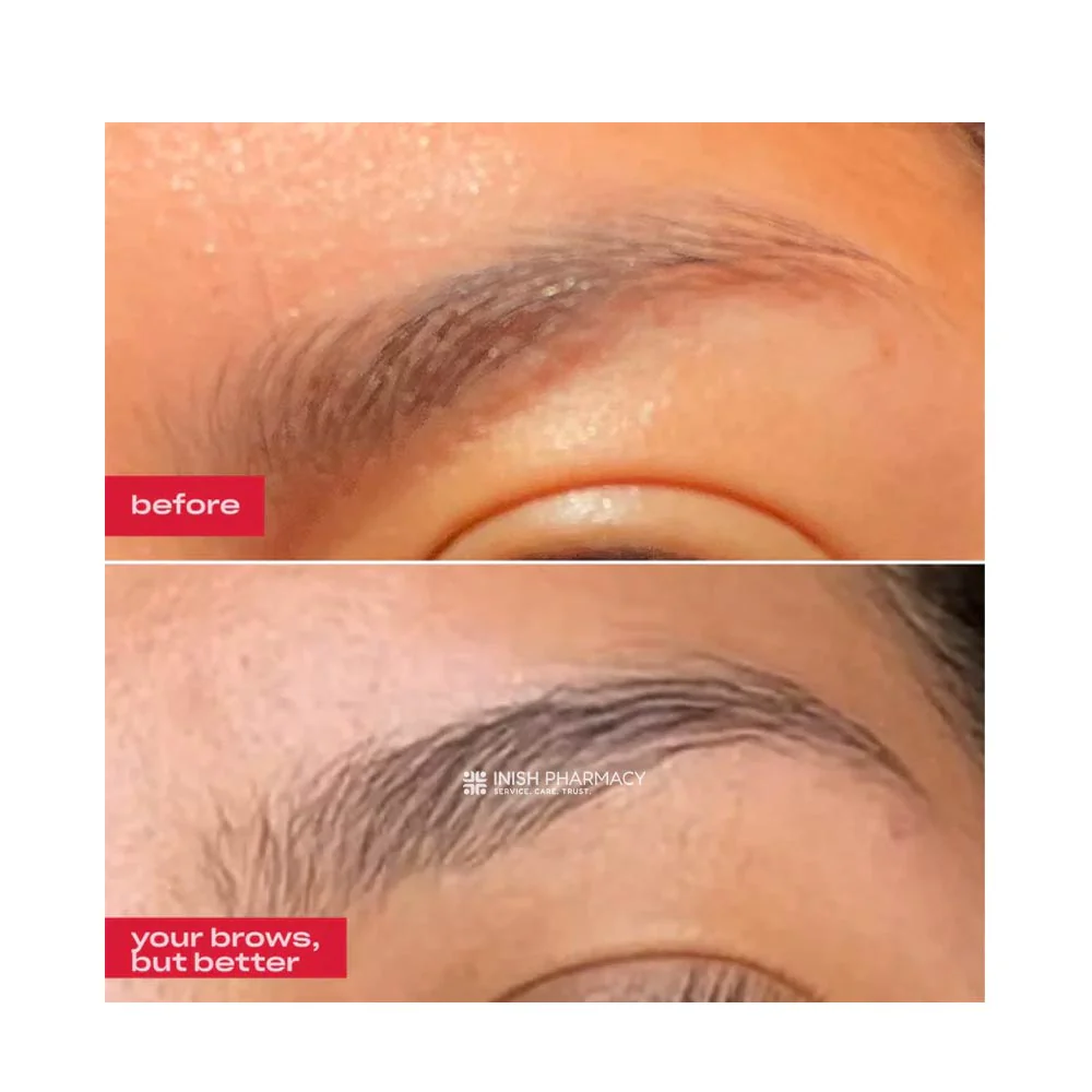 Groa Brow Enhancing Serum 3ml - Image 4
