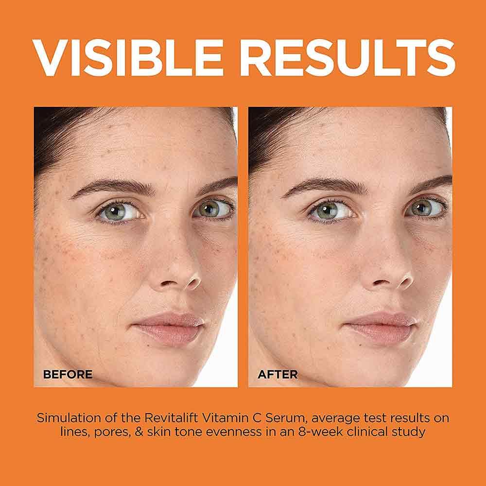 L’Oreal Revitalift Clinical 12% Pure Vitamin C Serum 30ml - Image 6