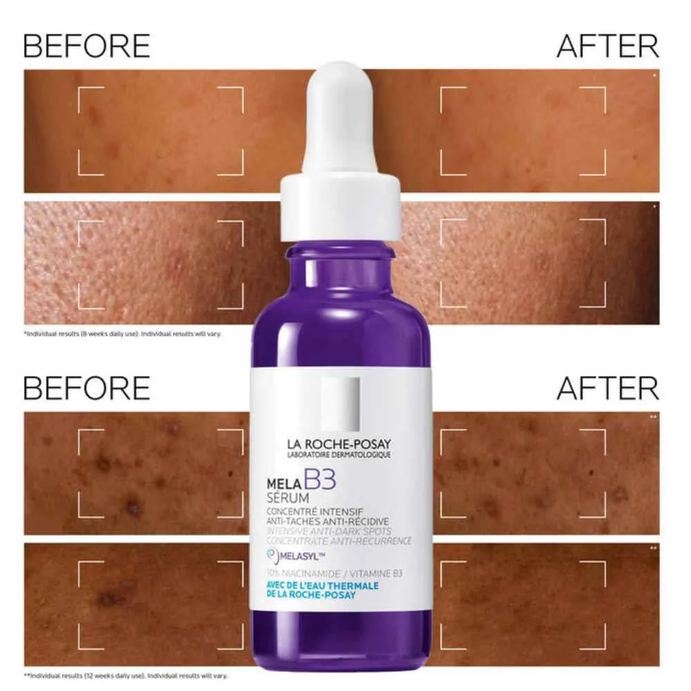 La Roche Posay Mela B3 Serum For Hyperpigmentation 30ml - Image 2