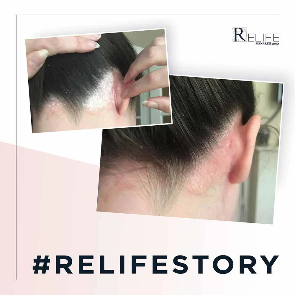 Relife U-Life 10 Ecofoam 100ml - Image 3