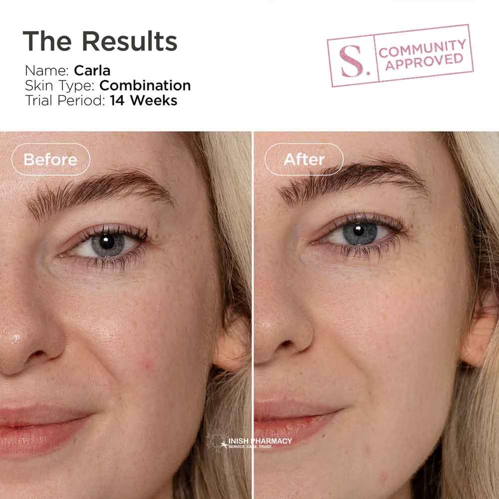 Sculpted by Aimee HydraBright Illuminating Serum with Vitamin C 50ml - Image 4