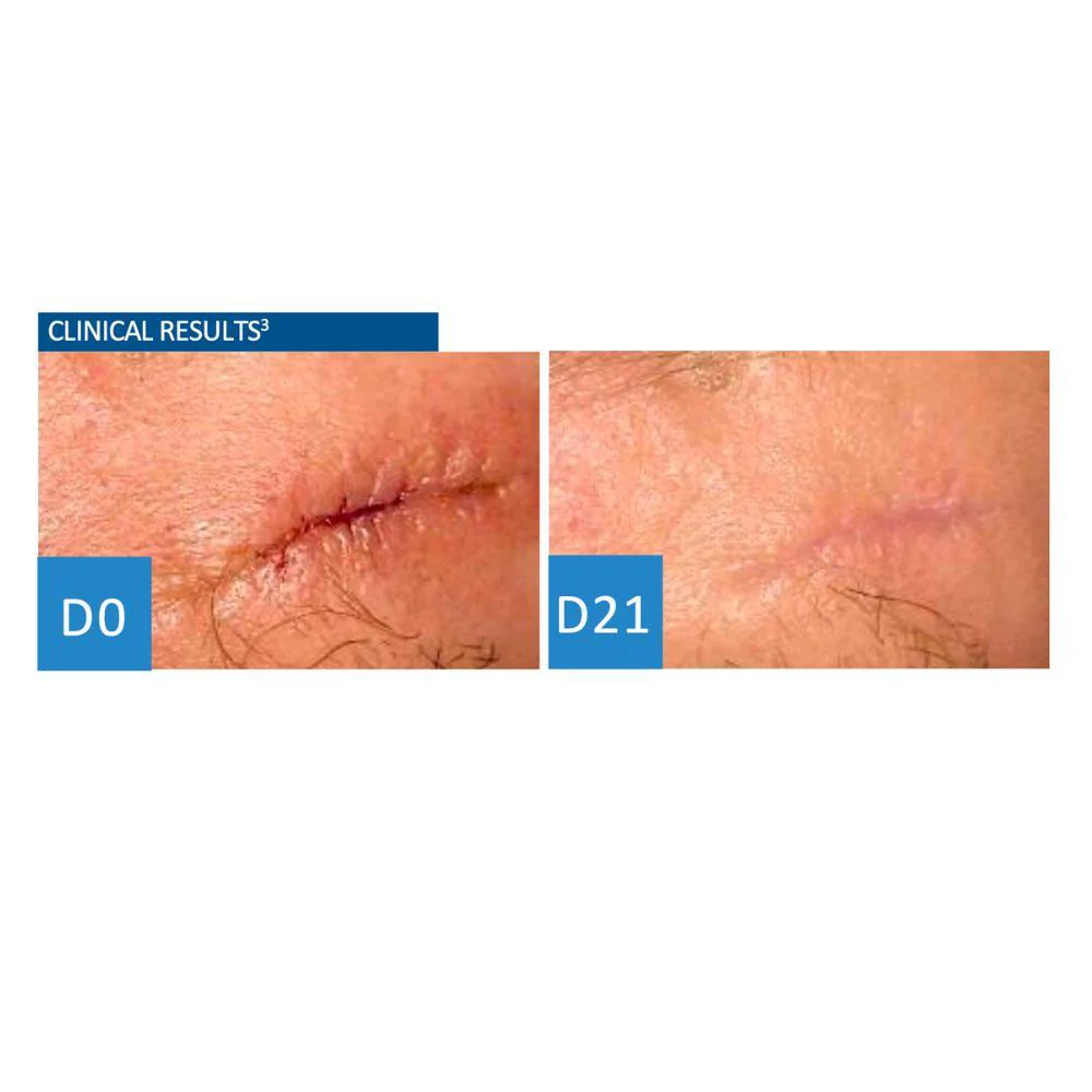 Uriage Bariederm Cica-Cream With Copper-Zinc 40ml - Image 2